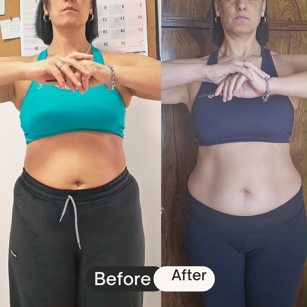 Antes y después — María G.