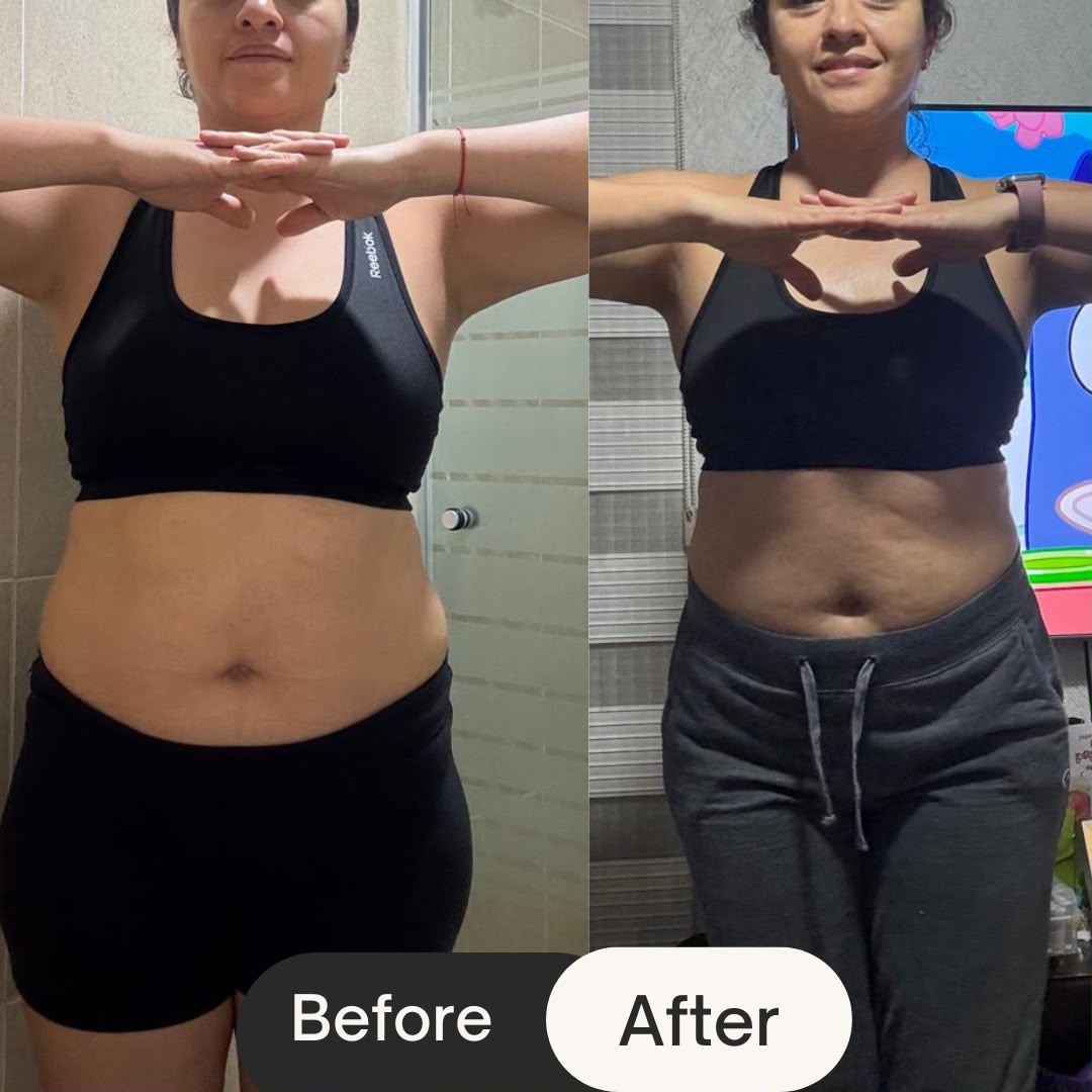 Antes y después — Laura P.
