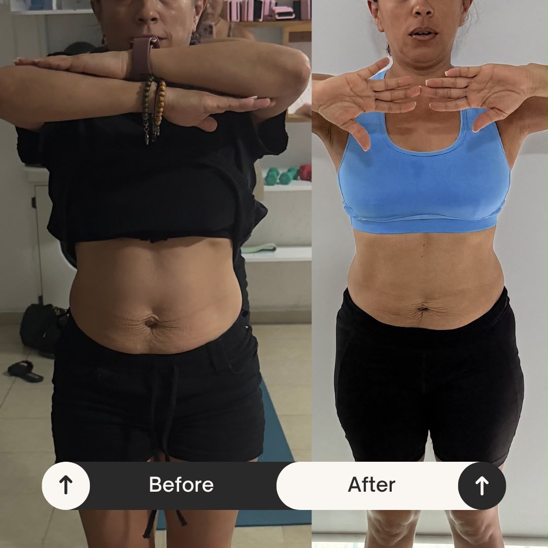 Antes y después — Sofía R.