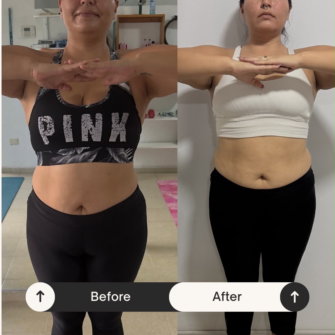 Antes y después — Daniela M.